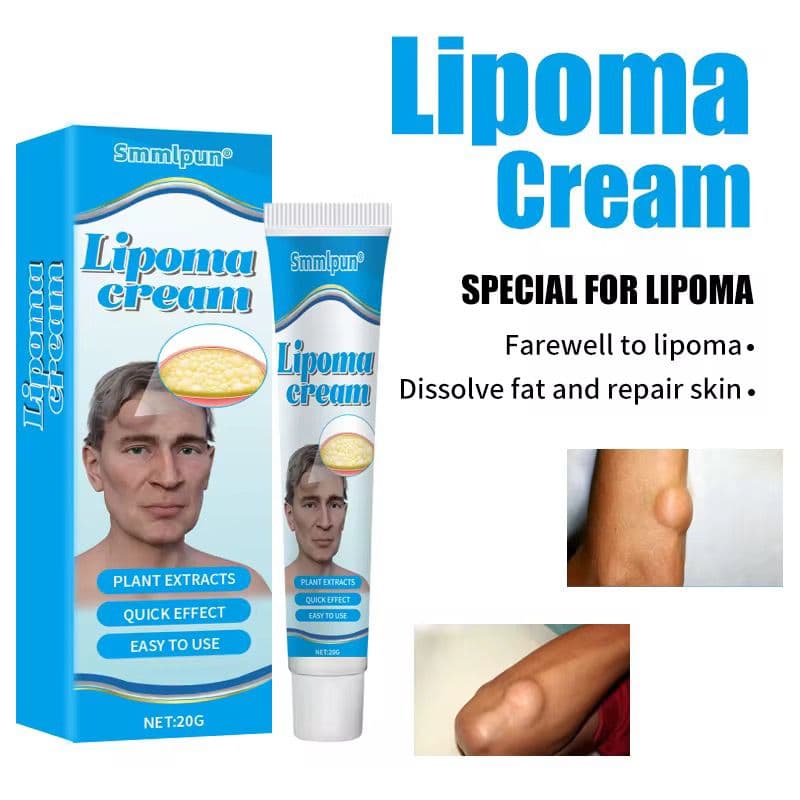 ADVANCED LIPOMA TREATMENT CREAM™