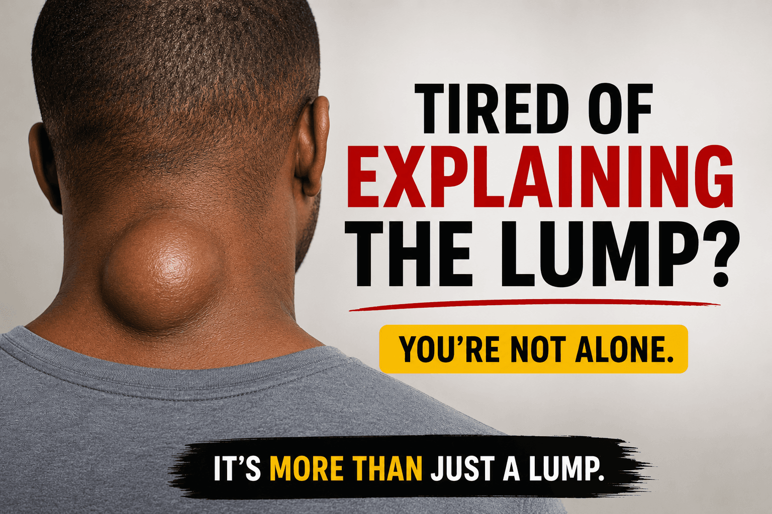 A visible lipoma under the skin